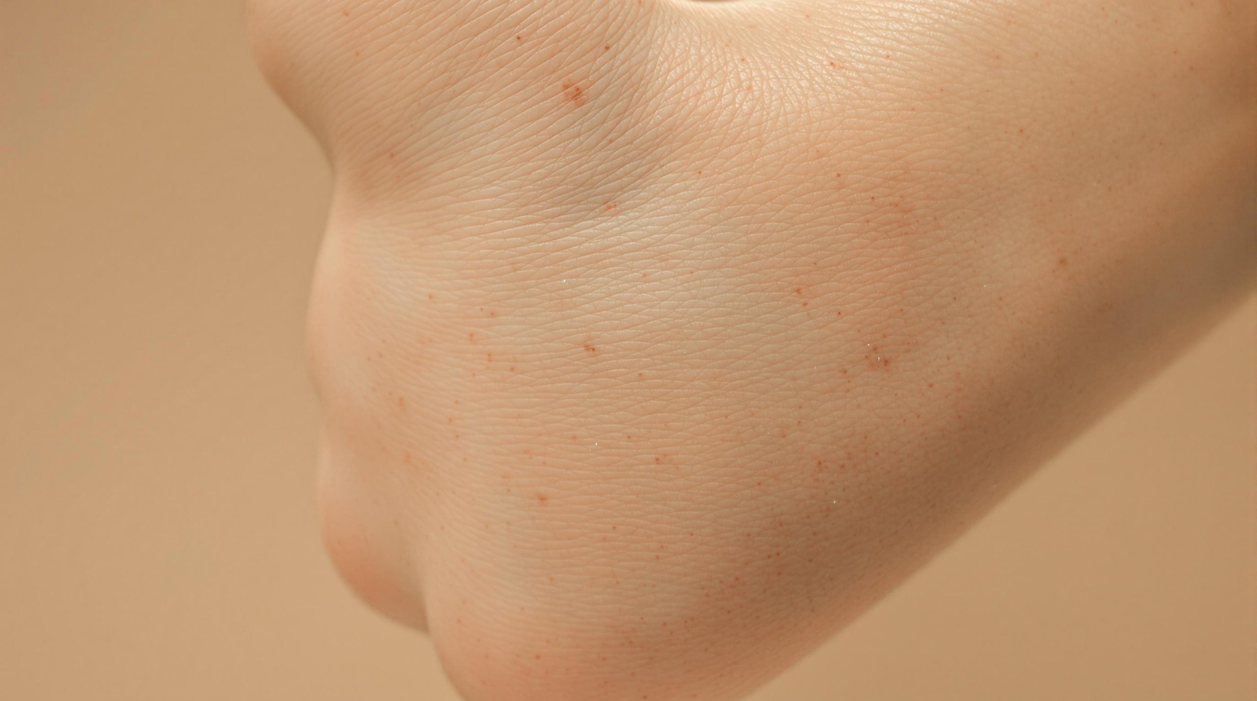Peau de fraise sur les bras : causes, traitements et conseils