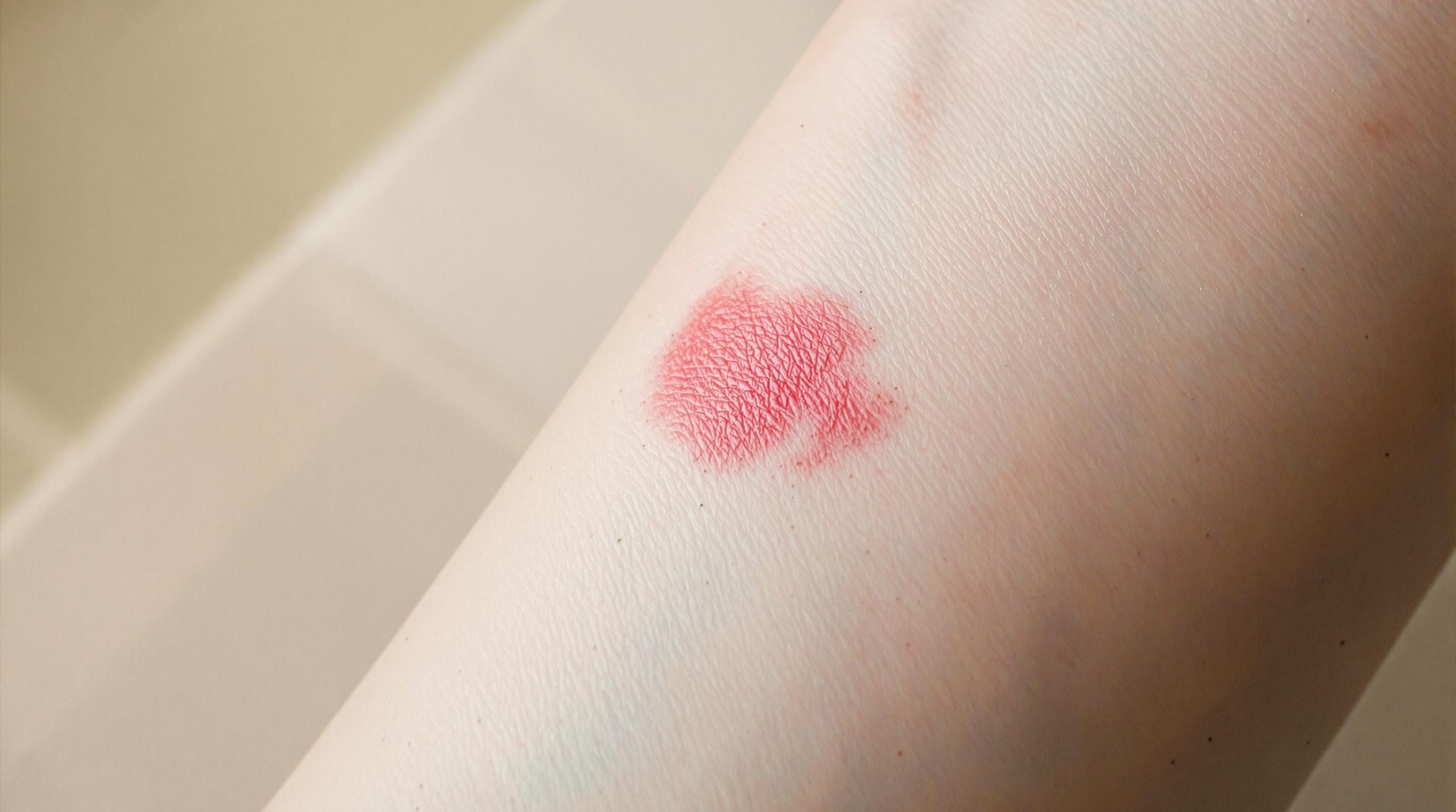 Cicatrice rouge : que faire ?